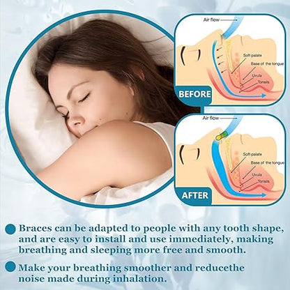 Anti Snoring Magnetic Nose Strips