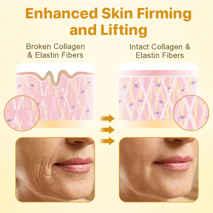 Botox Bee Venom Wrinkle Removal Lifting Cream