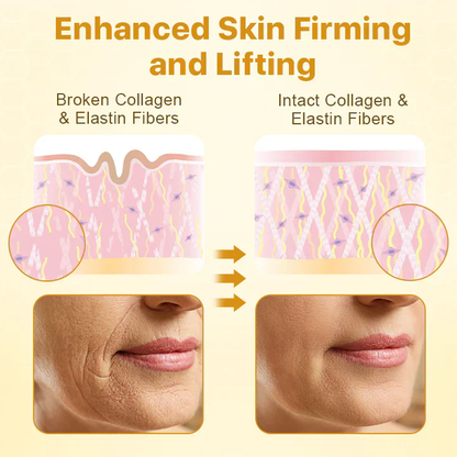 Botox Bee Venom Wrinkle Removal Lifting Cream