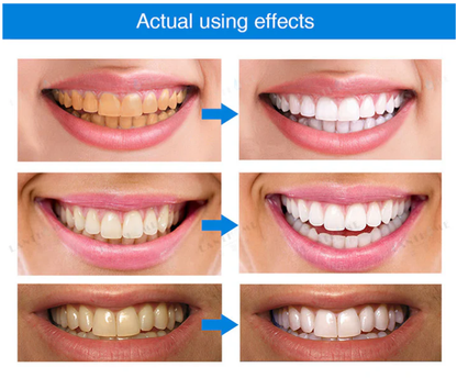 Teeth Whitening Essence