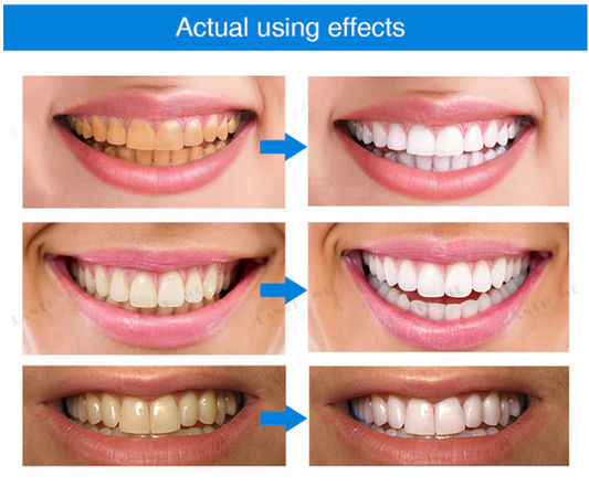 Teeth Whitening Essence